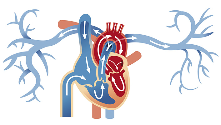 Gallery image for heart diagram